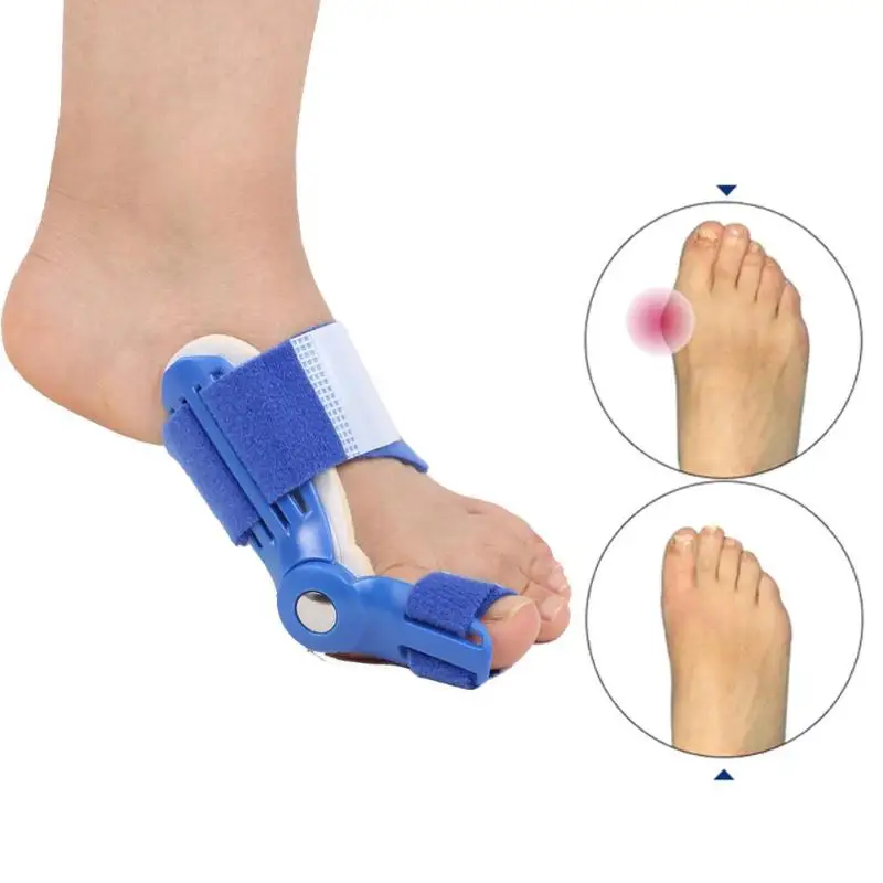Kék / Fehér Nagy Csont Toe Bütyök Sín Toe Hajegyenesítőt Korrektor Láb Fájdalom Hallux Valgus Korrekciós Ortopédiai Ellátás